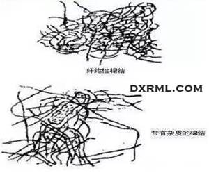 形成棉結的原因